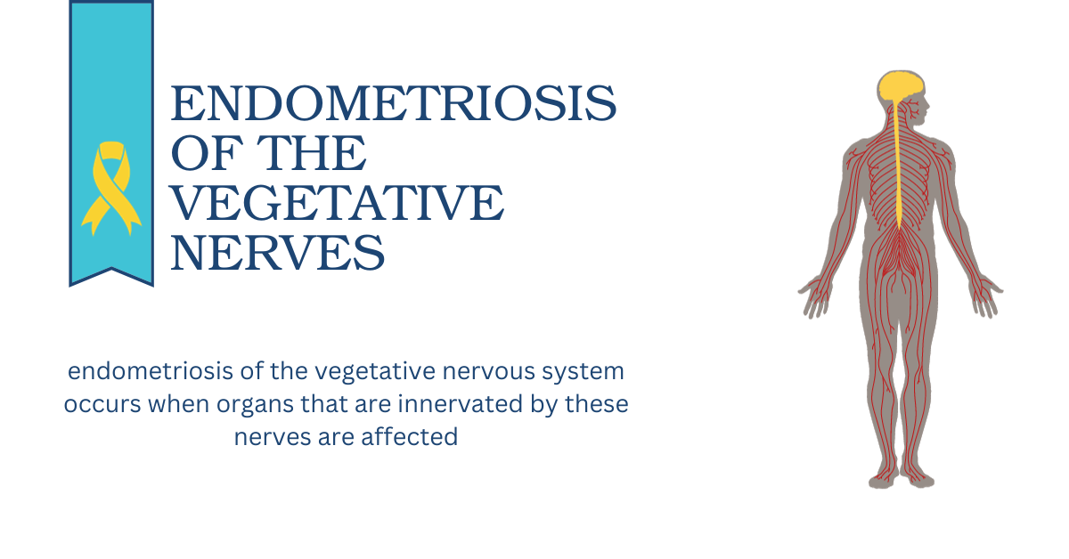 You are currently viewing Endometriosis of the vegetative pelvic nerves