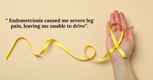 Read more about the article “Endometriosis caused me severe leg pain, leaving me unable to drive”